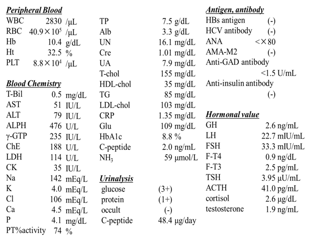 Alstrom Syndrome with a Mutation in Exon8 (C.4746C \u0026gt; A) of Alstrom ...